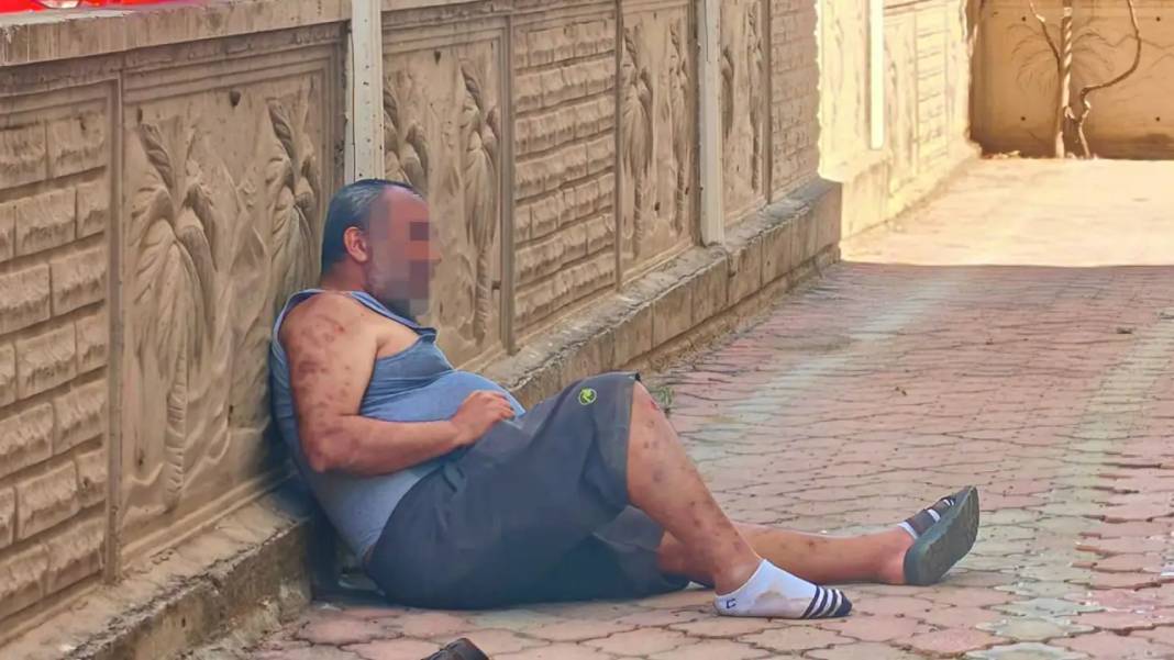 Antalya’da Kendini Yakmak İsteyen Adamı Bakın Kim İkna Etti? 7